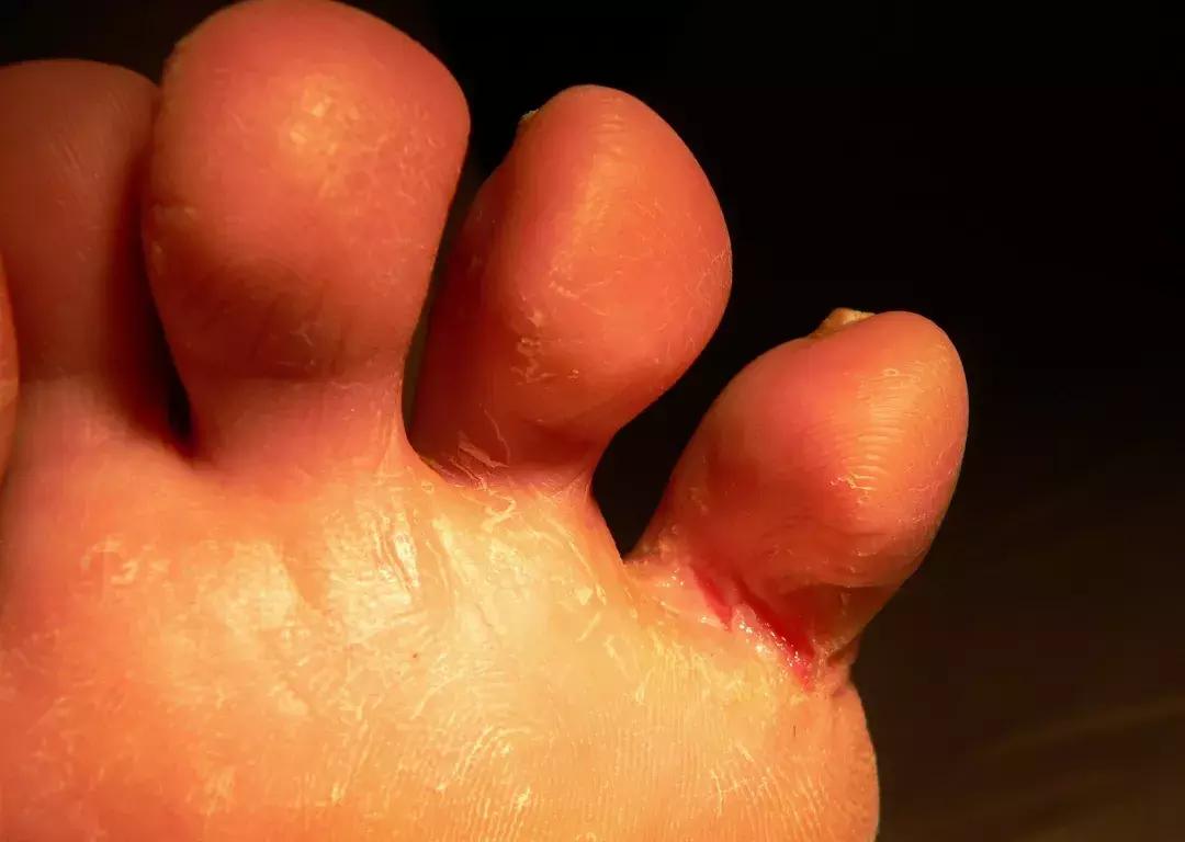 袜子裤头可以一起机洗吗,袜子裤子能一起洗吗