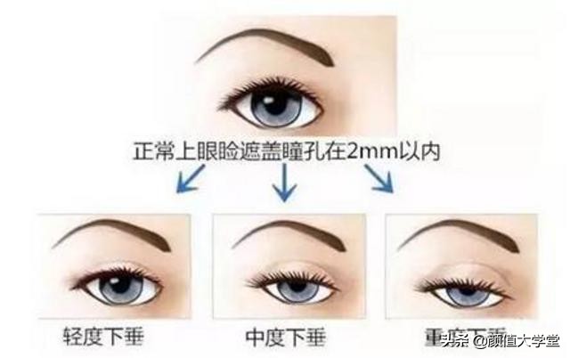 眼睛无神呆滞怎么好得快,眼睛无神呆滞怎么变好图片