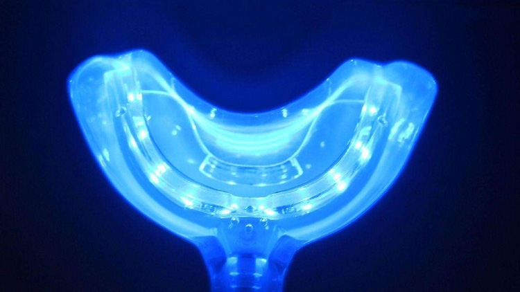 牙黄洗牙对牙齿伤害大吗,牙黄不洗牙可以让牙齿变白