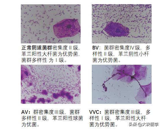 特殊时期的女人更要特殊“呵护”