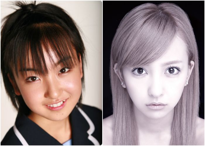 日本整容惊人案例,日本整容是不是最先进