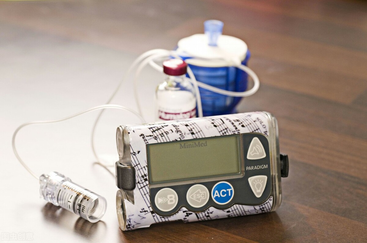 注射胰岛素一年血糖还是高,20岁姑娘胰岛素294正常吗