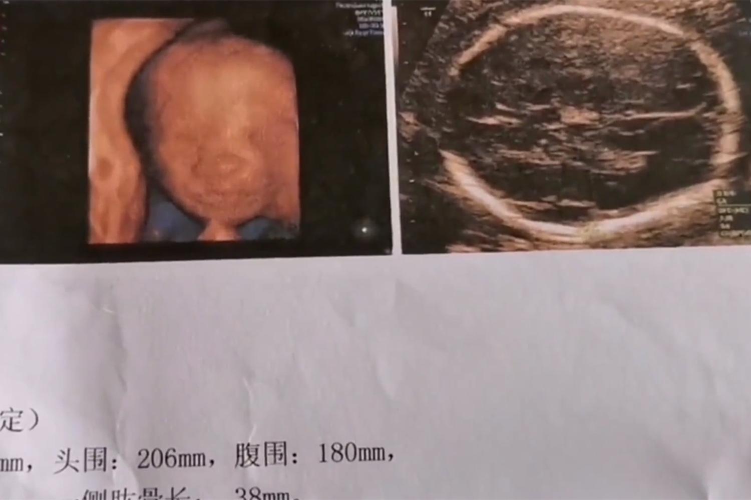 准妈妈被宝宝丑哭了,四维照的宝宝怎么这么丑