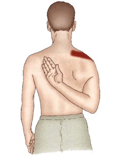 肩痛的原因及症状,突如其来的肩痛实在是难以忍受