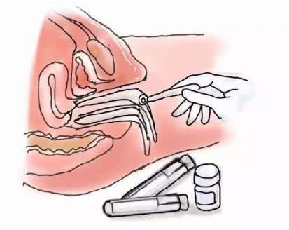 妇科检查子宫和卵巢用什么方法,妇科双合诊检查如何判断子宫大小