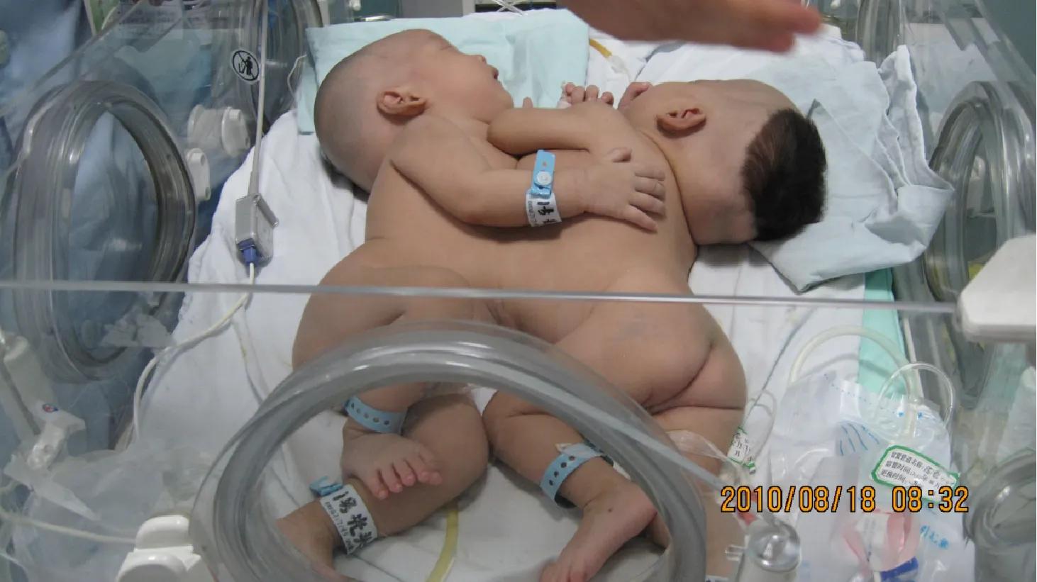 华华和西西最新视频,华华和西西近照