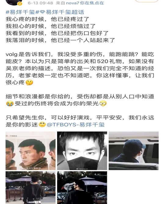 易烊千玺长津湖受伤不能跳舞了吗,易烊千玺长津湖受伤脸部特写