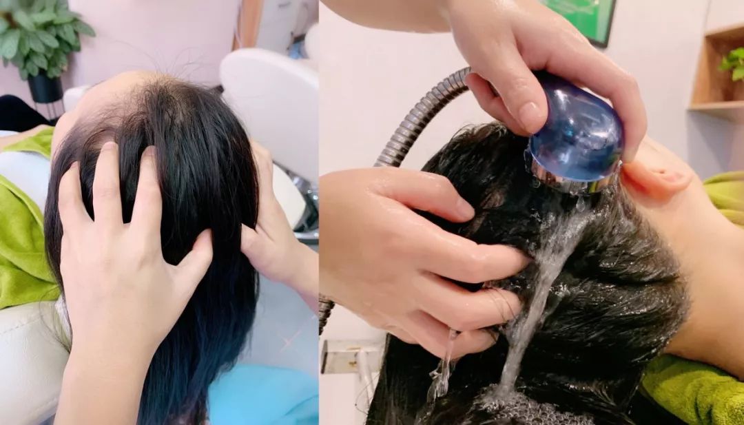 专家推荐治疗脱发白发食疗药酒,中医调理白发脱发养发