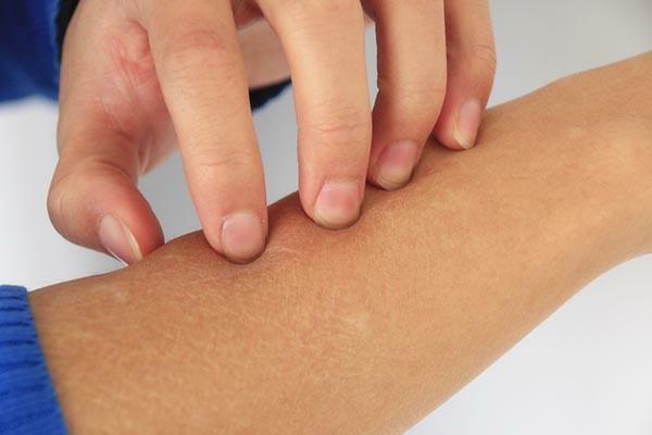 身上起红痣很痒怎么回事,身上突然起红痣很痒怎么回事