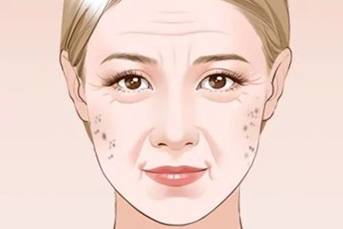 40岁开始脱发有老年斑怎么办,老年斑脱发怎么治疗