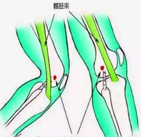 膝关节活动有响声应该看什么科室,膝关节活动有响声是怎么回事