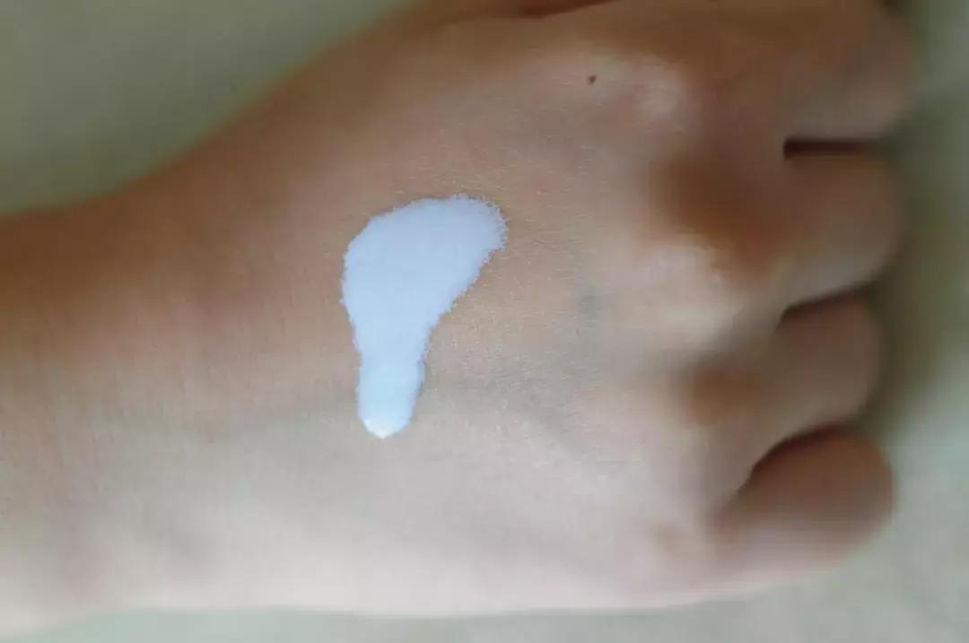 金银花对付痘痘,对付所有痘痘的药膏