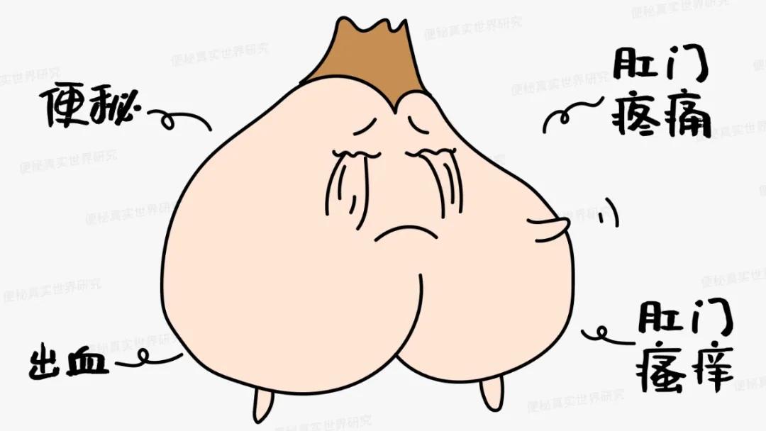 肛门疼痛、瘙痒、出血，到底是痔疮还是肛裂？