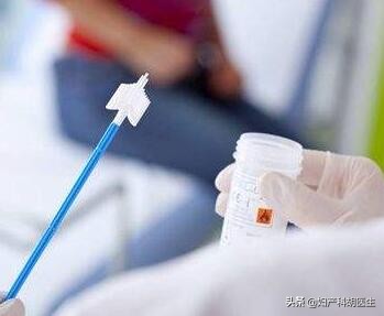 宫颈细胞学检查tct是怎样检查,如何看懂你的宫颈tct结果