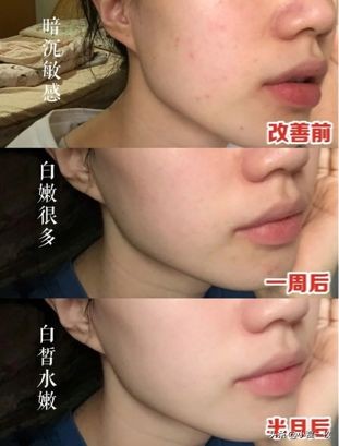 睡眠面膜12岁以上能用吗,适合30岁以上的睡眠面膜测评