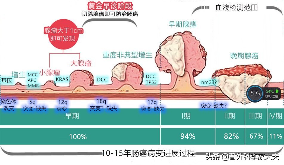 肠癌体质风险因素，来讨论直肠该如何保肛？
