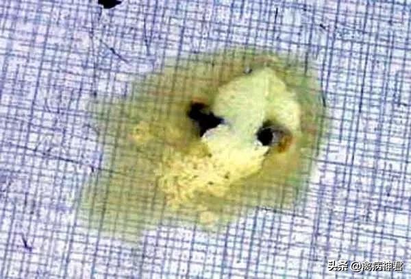 鸡黑痢怎么治疗,鸡咳嗽哮喘拉白痢用什么药治疗