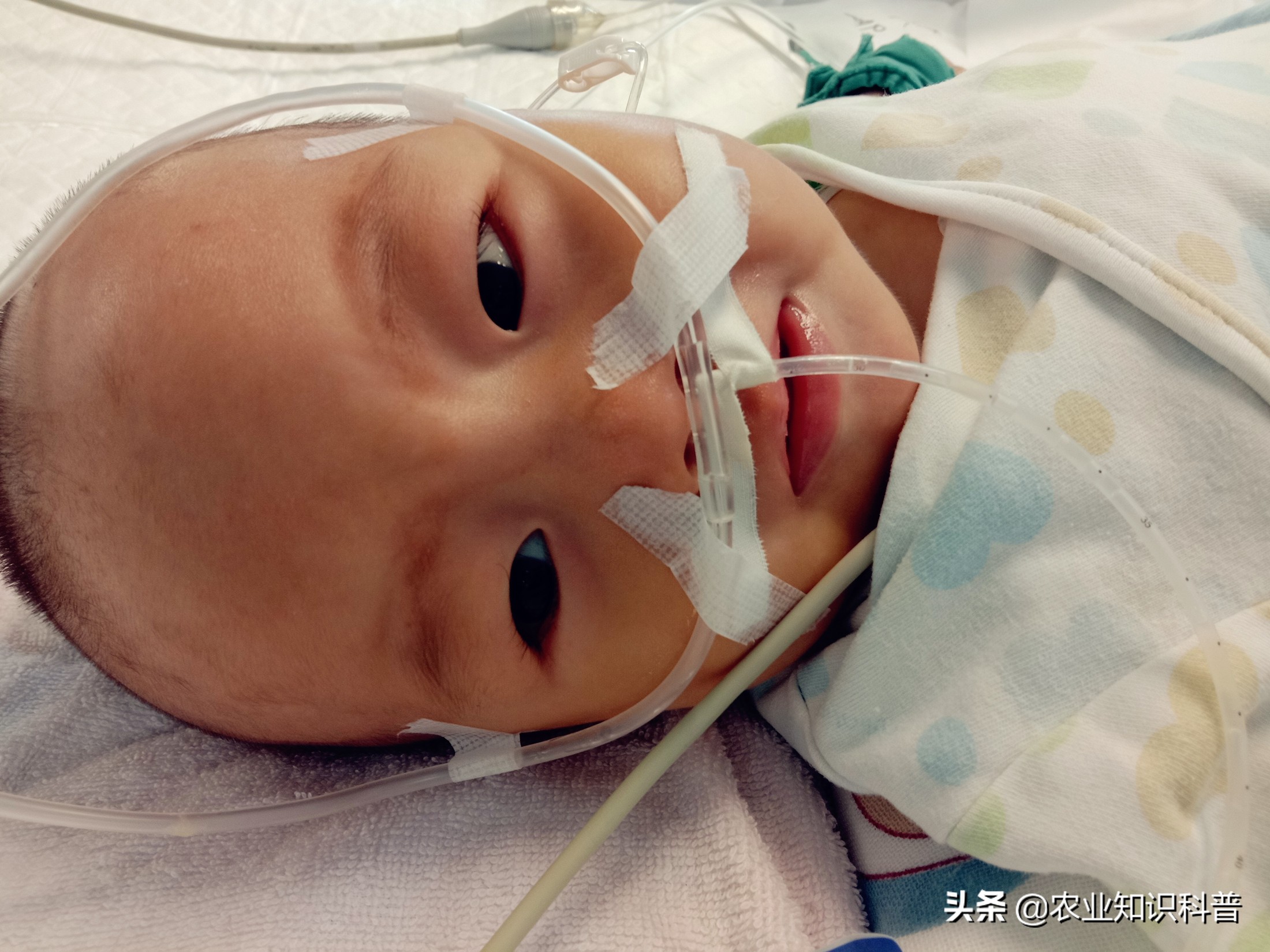 10个多月宝宝得病后续,10岁男孩患重病