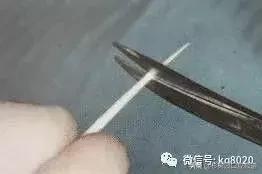 纤维桩的优点和缺点,看完这篇文章就明白了