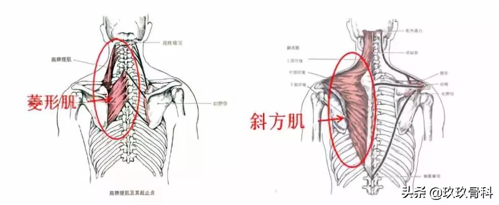哺乳期颈肩痛怎么缓解,久坐颈肩痛的缓解方法