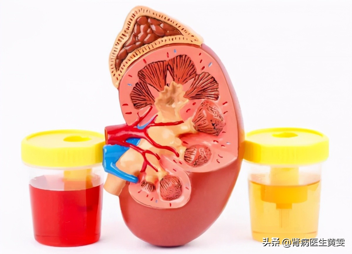 女孩肾病综合征能彻底治愈吗,妇女的肾病在中医怎么治疗