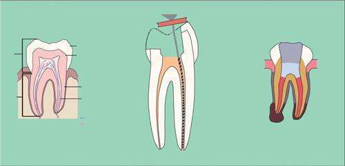 牙科的一些常识,牙科常见的问题和治疗方法