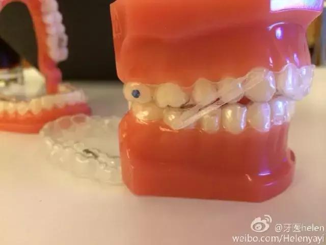 helen榻跨,Helen榻跨涓績