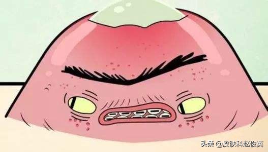 长痘痘代表可能不容易生病,长痘痘是不是不可能治好