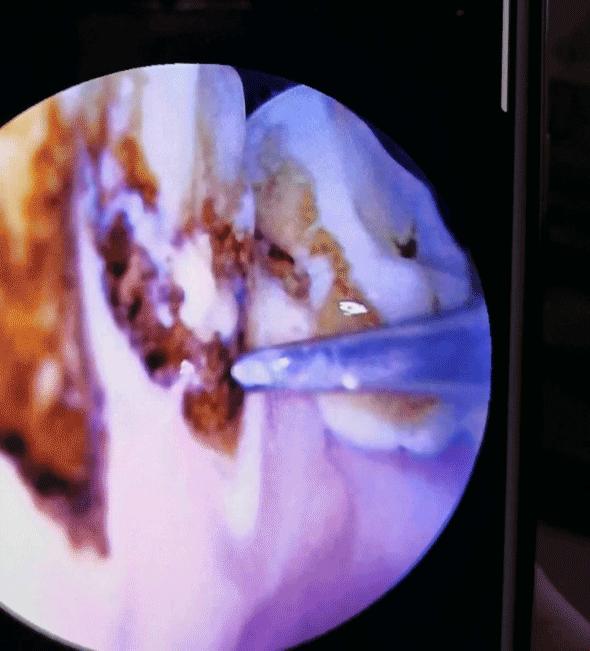 居家智能美容仪,素诺智能可视超声波洁牙仪t11pro