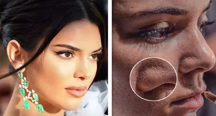 长黑头VS不长黑头差距这么大?精致女孩如何绕过黑头这道坎?