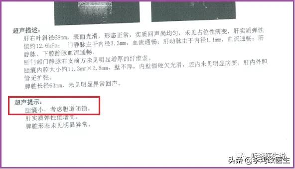 大便发黄被怀疑恶性肿瘤,病人皮肤黄