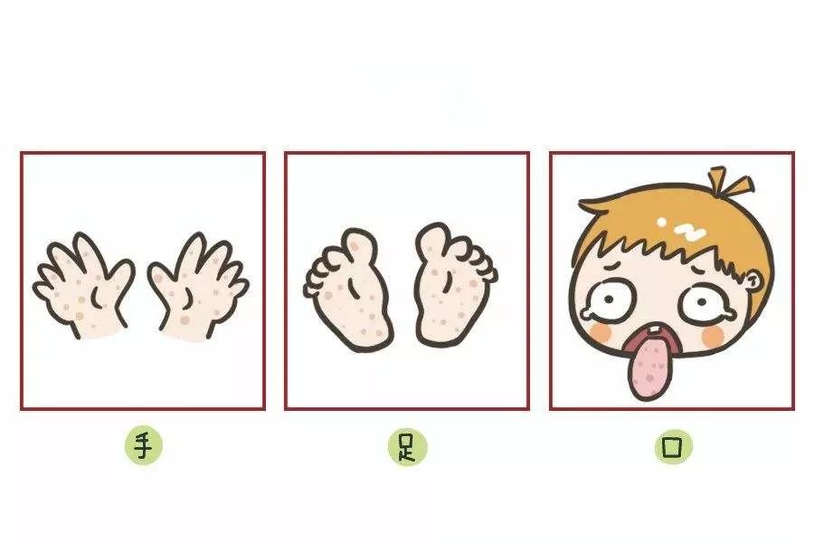 宝宝常见疾病大全与清晰护理策略,五种夏季儿童常见病该如何预防