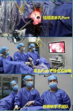 妇产科新技术怎么做,妇产科诊疗新技术