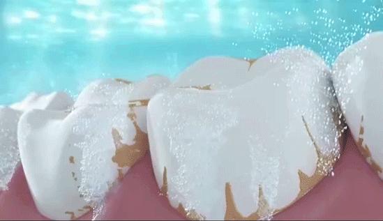 口腔专用香水,能持久留香的口腔香水