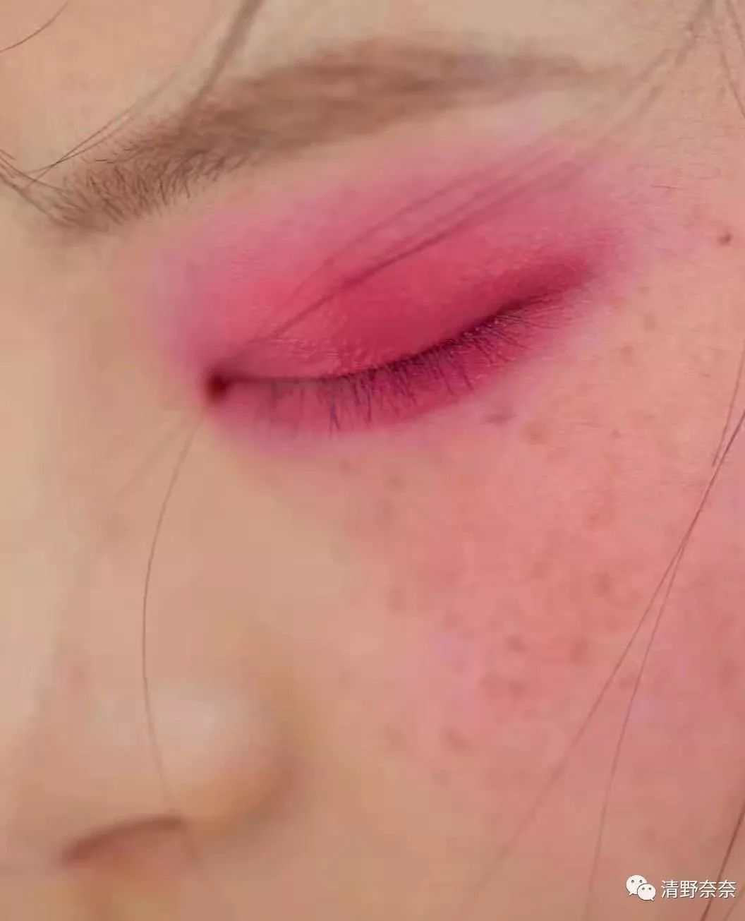 防晒霜过敏脸部自救方法,化妆品过敏紧急自救三步骤