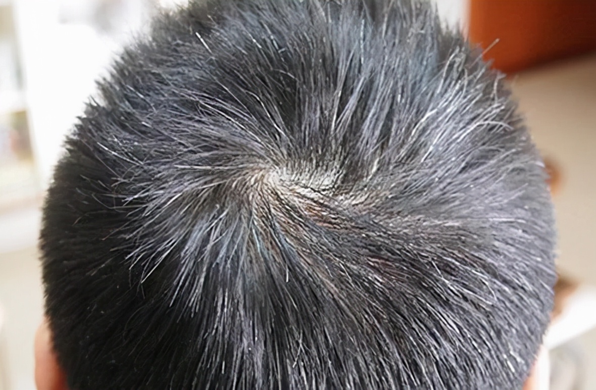 有白头发最好不要染,日常多吃这3种食物,或许可以让白发少些