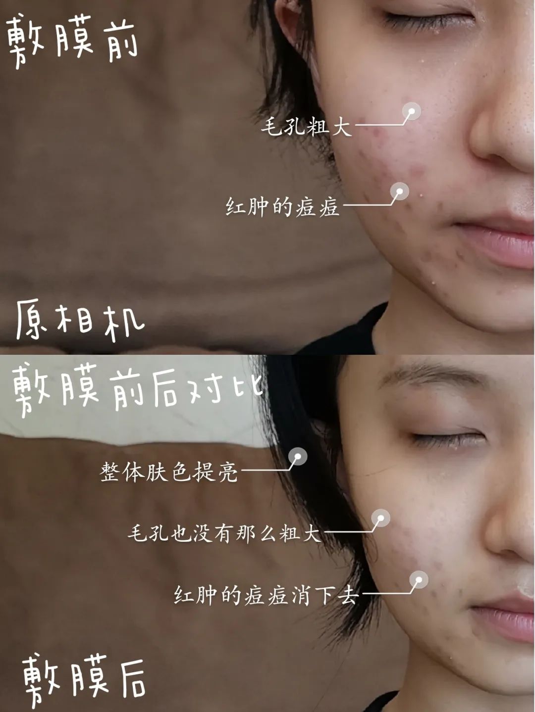 小玛急救水修护霜,小玛急救水值得入手吗