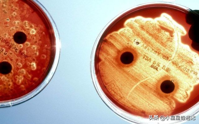 人类死亡后身体的恐怖变化,人类死之后身体会发生哪些变化