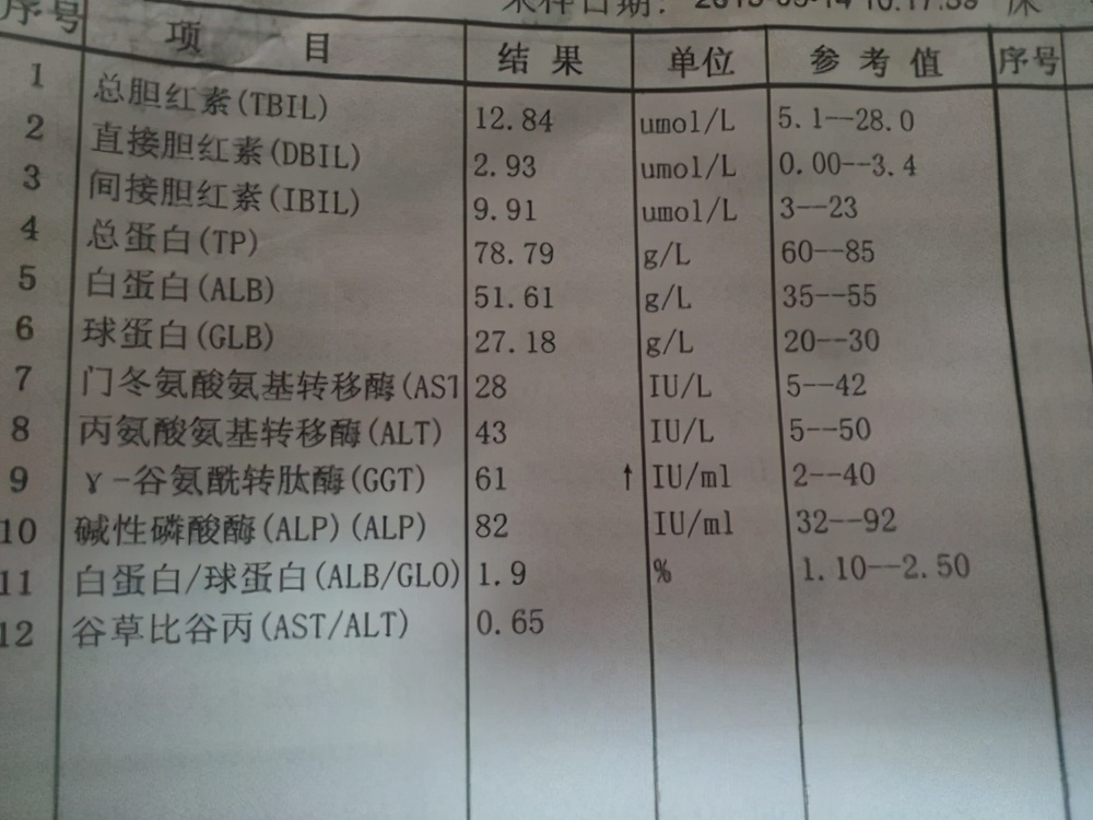 肝功能肾功能化验单怎么看,肝功能11项化验单解读