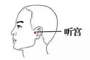 耳鸣治得好不,耳鸣要注意什么事项