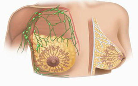 孕期哺乳期胸下垂怎么办,孕妈妈注意避免什么动作