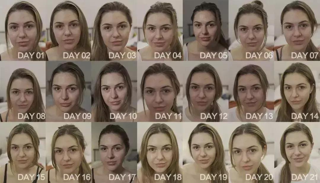 泰国女子打6年美白针六胜肽,女子打美白针后身患多病