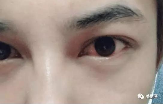 为什么说不建议女人纹“美瞳线”？美容师透露：最好看完再做决定