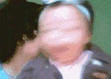 胳膊上的小圆疤是什么,每个人胳膊上的疤是怎么长出来的