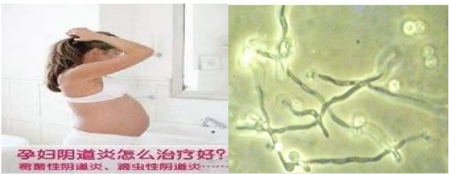 引起女性私密疾病原因有哪些？