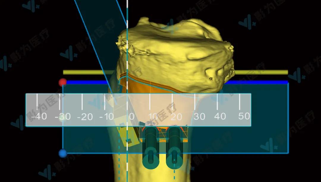 安医大阜阳附属医院减重,阜阳市颍州区安医大附属阜阳医院