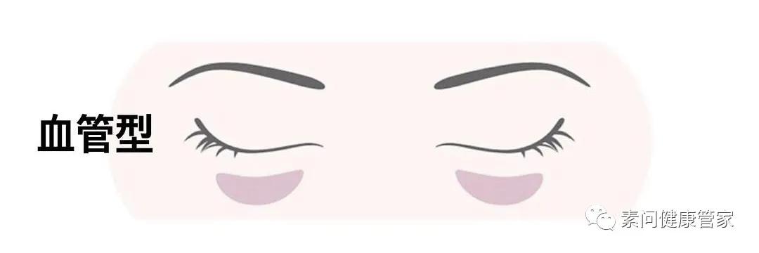 你的黑眼圈是天生的吗,化疗为什么有黑眼圈