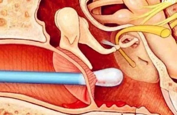 妈妈一个动作导致孩子脾脏破裂,妈妈的一个动作让宝宝浑身发抖