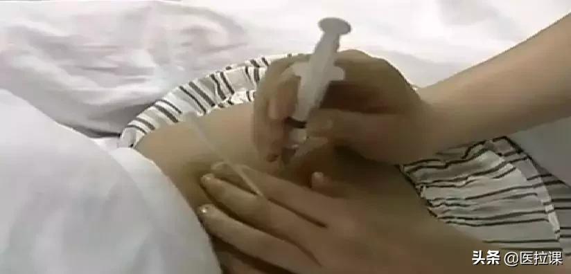 护理学注射法名词解释,基础护理学注射法视频