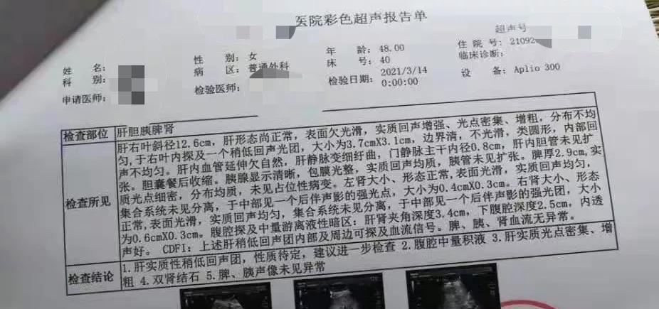 肝癌没做病理怎么报销保险,肝癌早期可以报保险吗